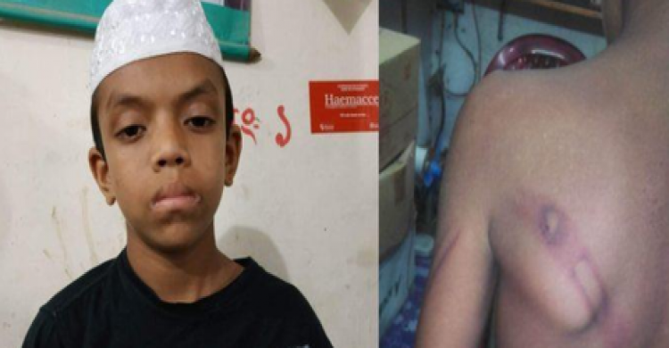 রৌমারীতে শিশু নির্যাতনের অভিযােগে মাদ্রাসার শিক্ষক আটক