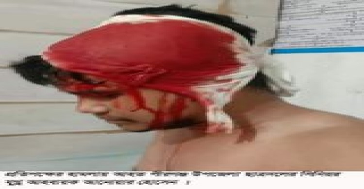 পীরগঞ্জে ছাত্রদল নেতাকে হত্যা চেষ্টা মামলায় গ্রেফতার-১