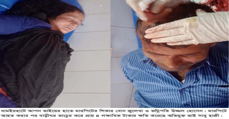 ধামইরহাটে আপন ভাইয়ের হাতে নির্যাতনের শিকার বোন-ভগ্নিপতি, হামলা ভাংচুর করে ৪ লক্ষাধিক টাকার ক্ষতি সাধন
