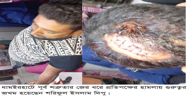 ধামইরহাটে প্রতিপক্ষের হামলায় জখম-১